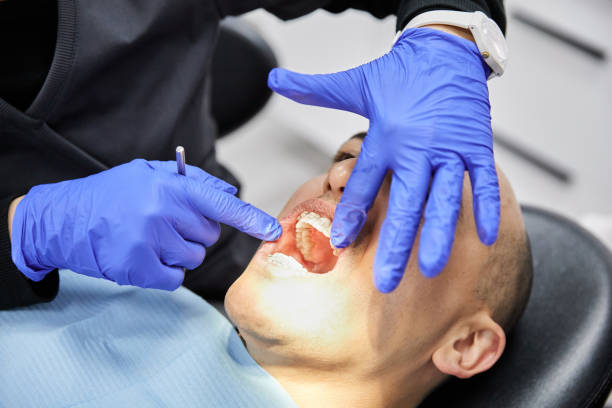 Best Emergency Gum Treatment in Youngstown, OH